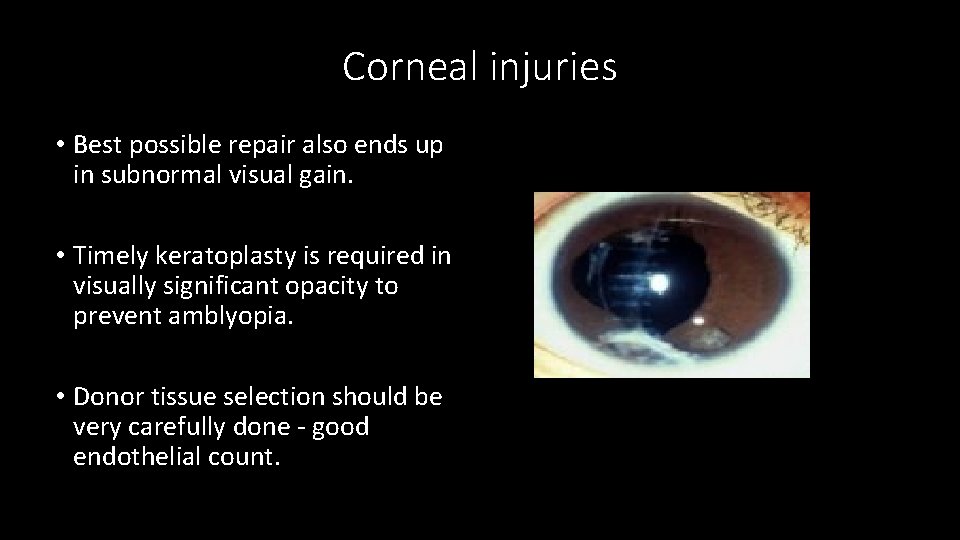 Corneal injuries • Best possible repair also ends up in subnormal visual gain. •