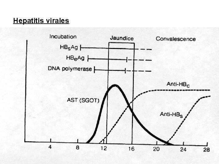 Hepatitis virales 