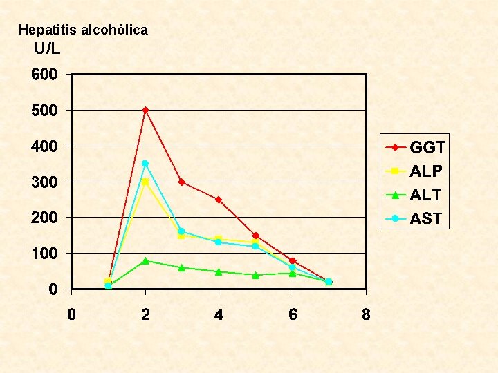 Hepatitis alcohólica U/L 