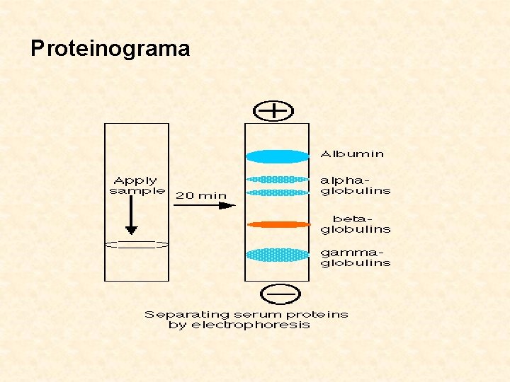 Proteinograma 