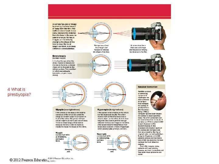 4 What is presbyopia? © 2012 Pearson Education, Inc. 