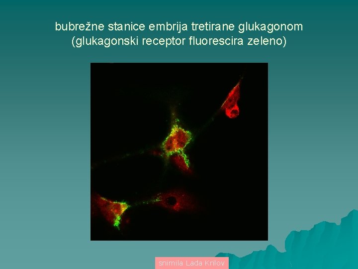 bubrežne stanice embrija tretirane glukagonom (glukagonski receptor fluorescira zeleno) snimila Lada Krilov 