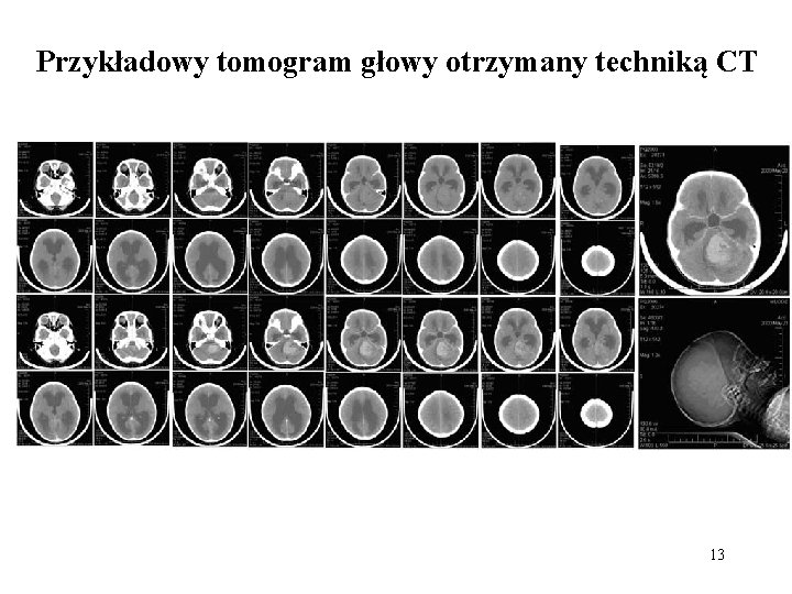 Przykładowy tomogram głowy otrzymany techniką CT 13 