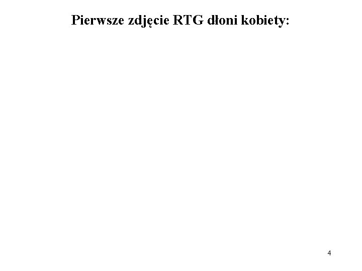 Pierwsze zdjęcie RTG dłoni kobiety: 4 