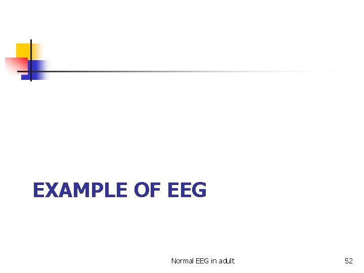 EXAMPLE OF EEG Normal EEG in adult 52 