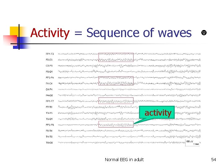 Activity = Sequence of waves ☻ activity Normal EEG in adult 54 