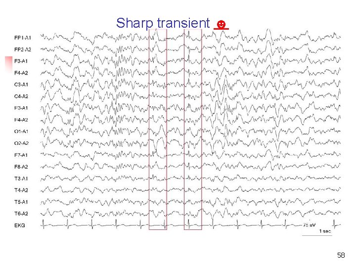 Sharp transient ☻ Sharp transient 58 