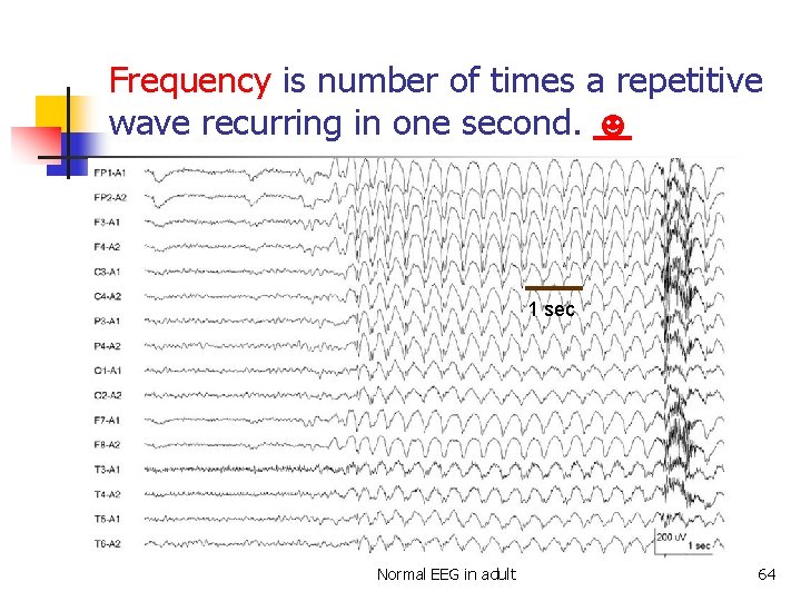 Frequency is number of times a repetitive wave recurring in one second. ☻ 1