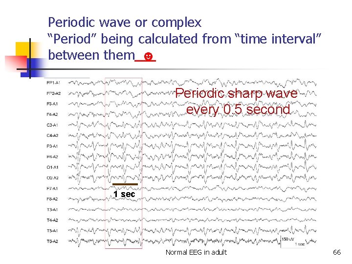 Periodic wave or complex “Period” being calculated from “time interval” between them ☻ Periodic