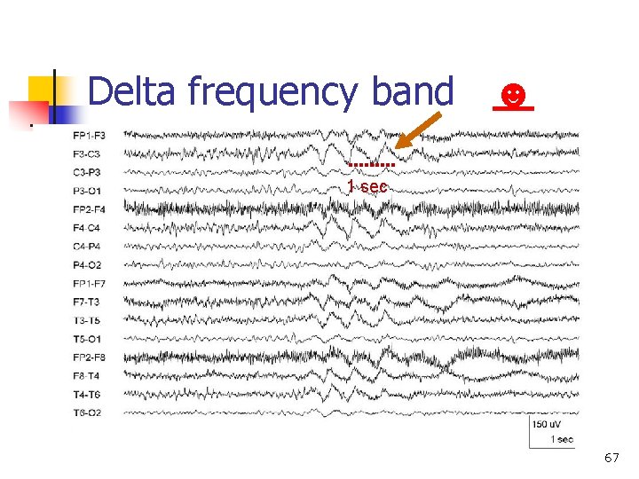 Delta frequency band ☻ 1 sec 67 