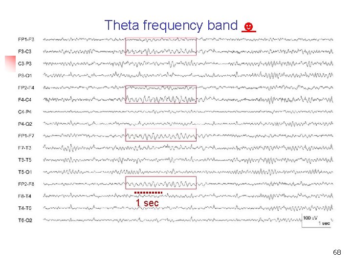 Theta frequency band ☻ Theta frequency band 1 sec 68 