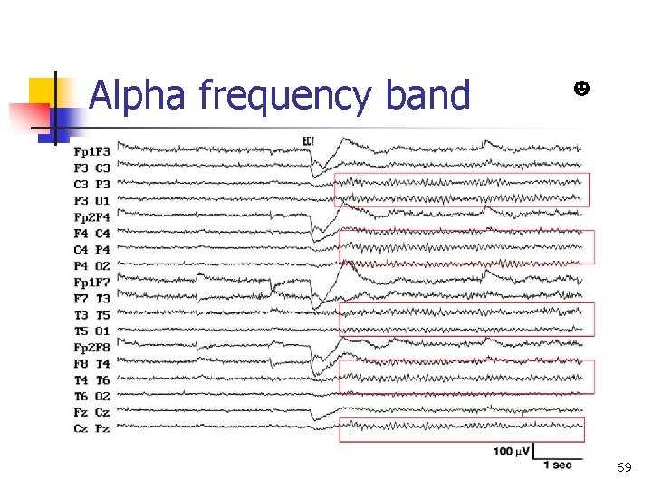 Alpha frequency band Normal EEG in adult ☻ 69 