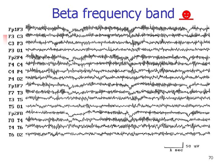 Beta frequency band ☻ Beta frequency band 70 