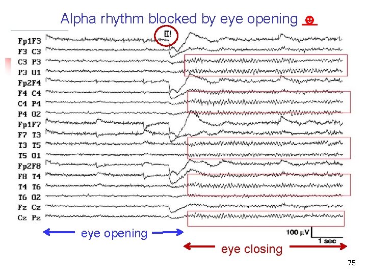 Alpha rhythm blocked by eye opening ☻ Alpha rhythm blocked by eye closure eye