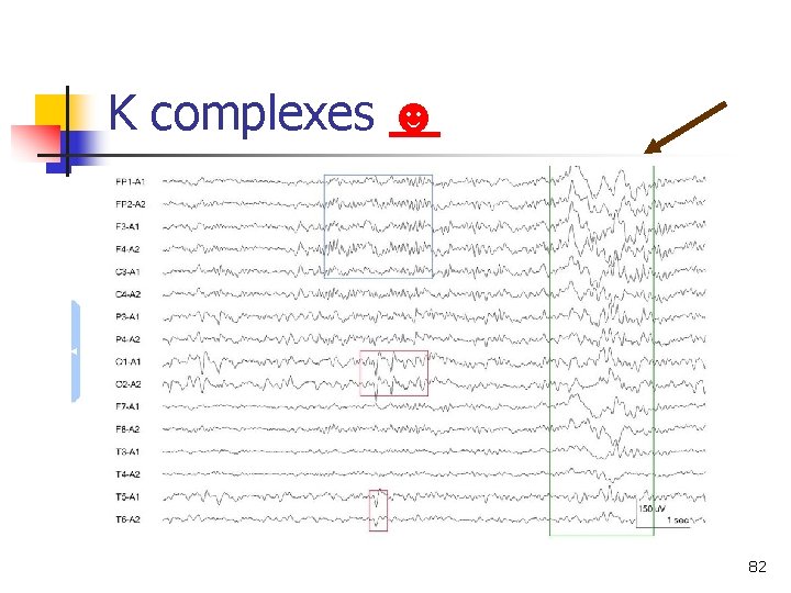 K complexes ☻ 82 