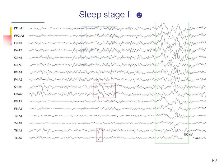 Sleep stage II ☻ 87 