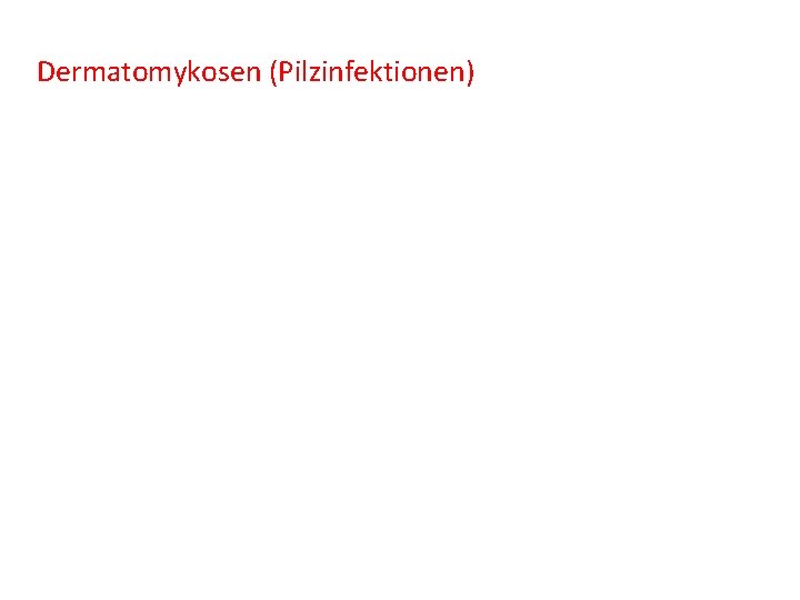 Dermatomykosen (Pilzinfektionen) 