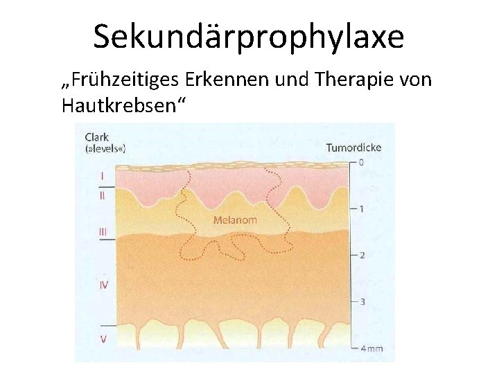 Sekundärprophylaxe „Frühzeitiges Erkennen und Therapie von Hautkrebsen“ 