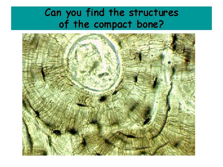 Can you find the structures of the compact bone? 