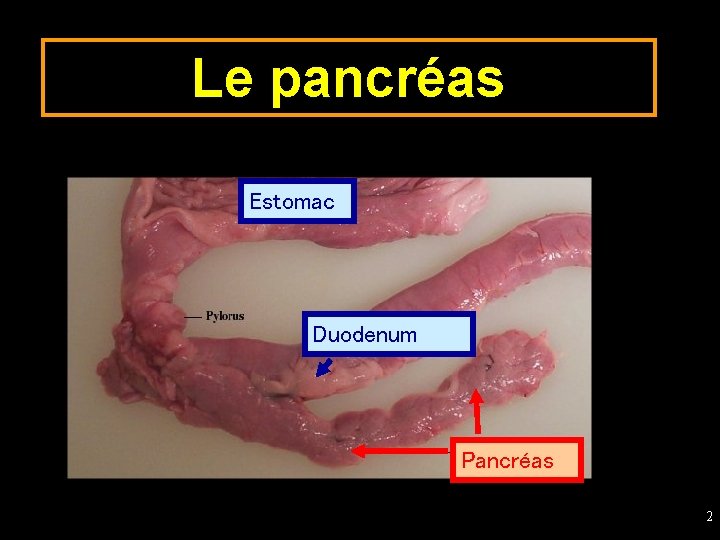 Le pancréas Estomac Duodenum Pancréas 2 