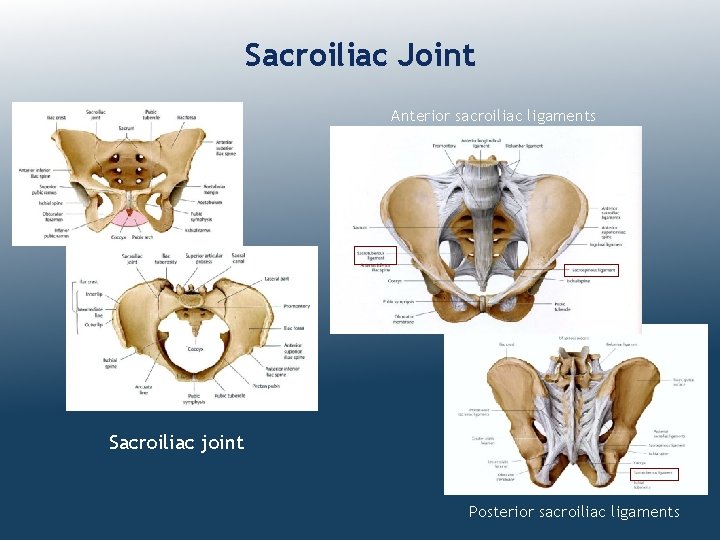 Sacroiliac Joint Anterior sacroiliac ligaments Sacroiliac joint Posterior sacroiliac ligaments 