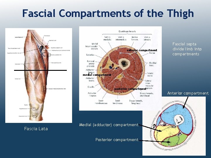 Fascial Compartments of the Thigh anterior compartment Fascial septa divide limb into compartments medial