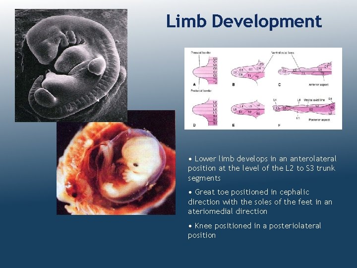 Limb Development • Lower limb develops in an anterolateral position at the level of