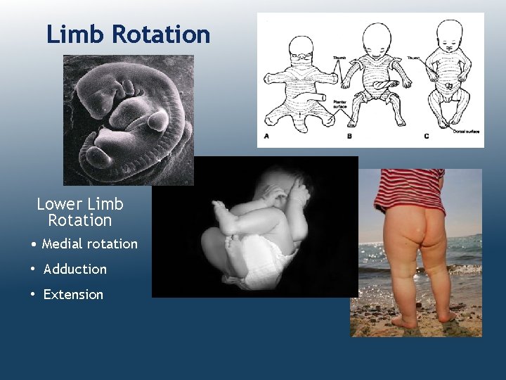 Limb Rotation Lower Limb Rotation • Medial rotation • Adduction • Extension 