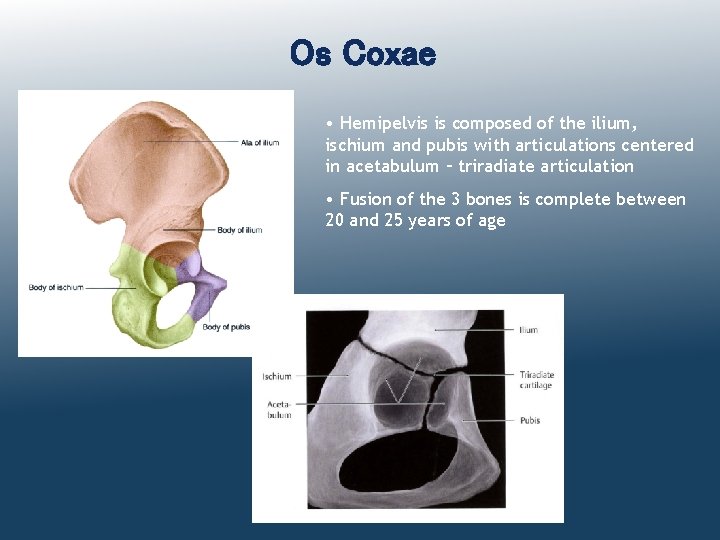 Os Coxae • Hemipelvis is composed of the ilium, ischium and pubis with articulations