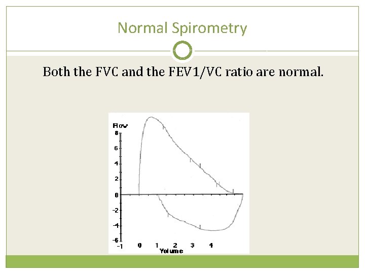 Normal Spirometry Both the FVC and the FEV 1/VC ratio are normal. 