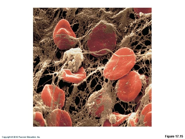 Copyright © 2010 Pearson Education, Inc. Figure 17. 15 