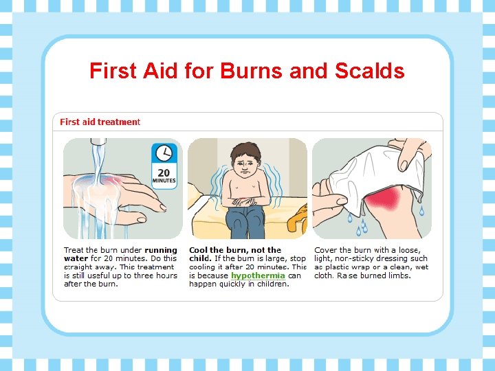 First Aid for Burns and Scalds 