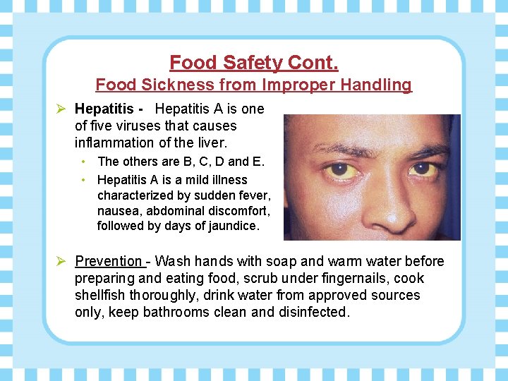Food Safety Cont. Food Sickness from Improper Handling Ø Hepatitis - Hepatitis A is