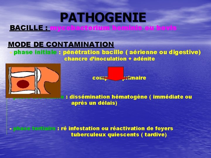 PATHOGENIE BACILLE : mycobacterium hominis ou bovis MODE DE CONTAMINATION - phase initiale :