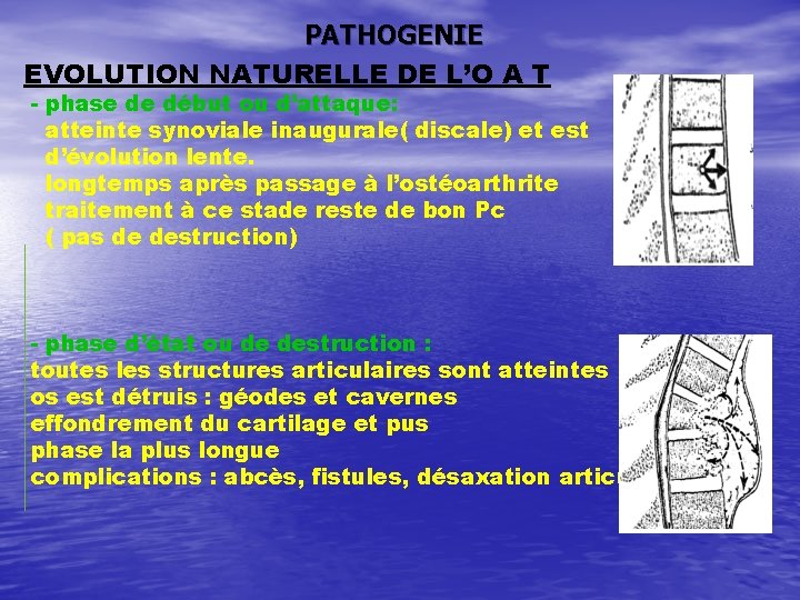 PATHOGENIE EVOLUTION NATURELLE DE L’O A T - phase de début ou d’attaque: atteinte