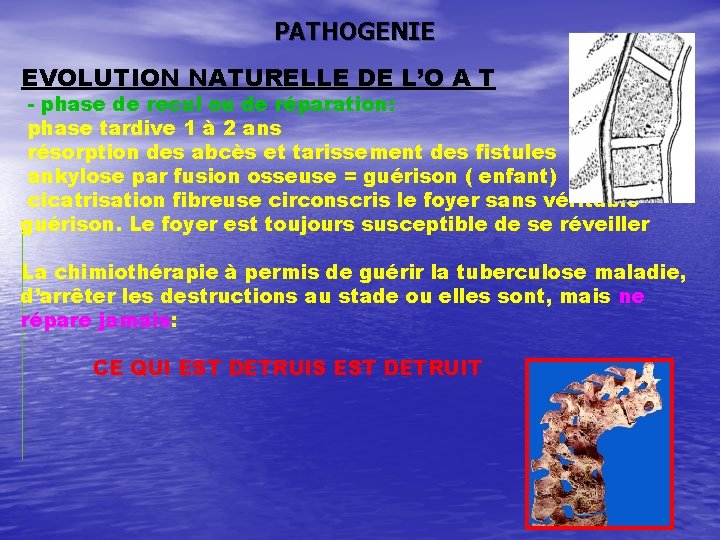 PATHOGENIE EVOLUTION NATURELLE DE L’O A T - phase de recul ou de réparation: