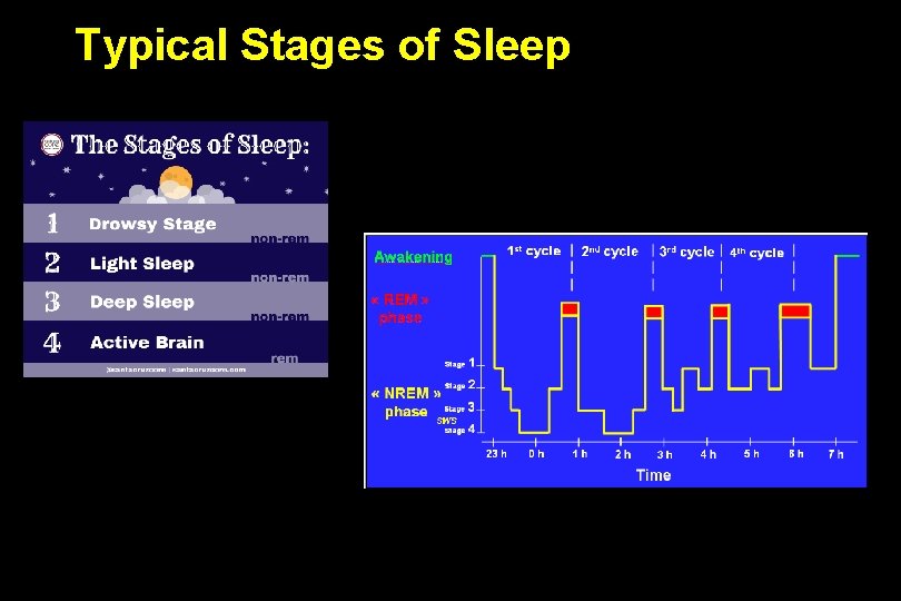 Typical Stages of Sleep 