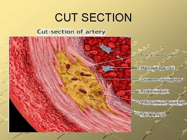 CUT SECTION 