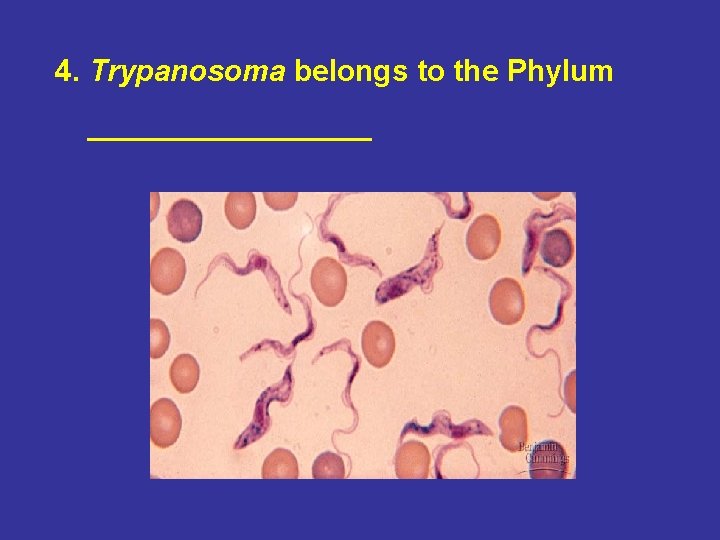 4. Trypanosoma belongs to the Phylum _________ 