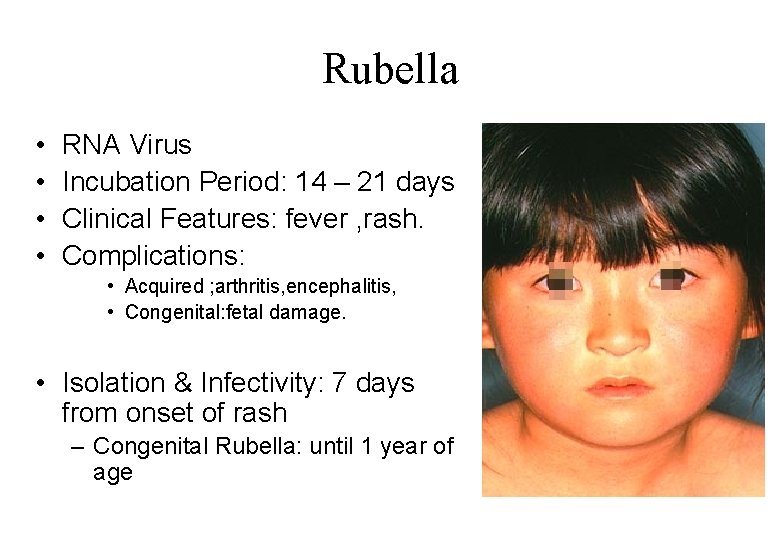Rubella • • RNA Virus Incubation Period: 14 – 21 days Clinical Features: fever