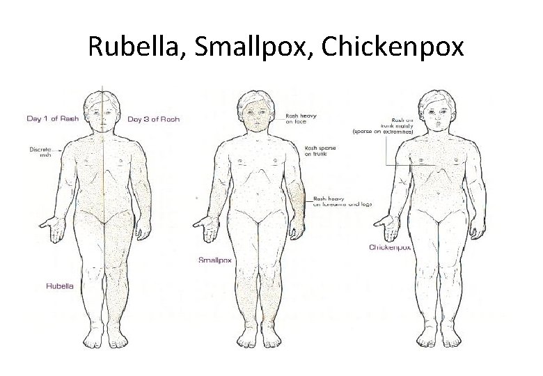 Rubella, Smallpox, Chickenpox 
