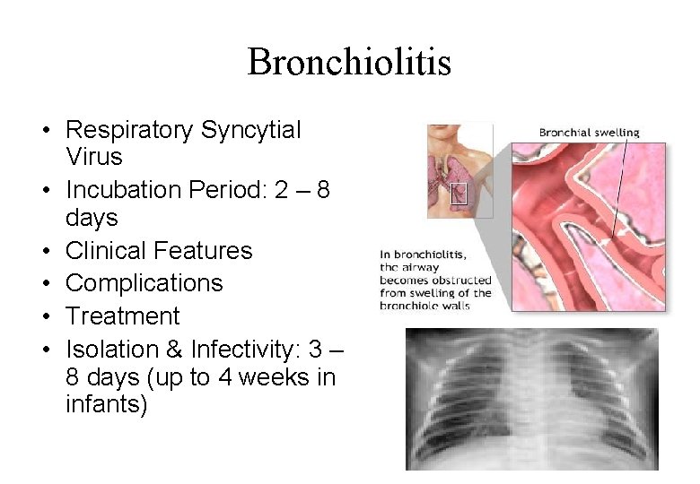 Bronchiolitis • Respiratory Syncytial Virus • Incubation Period: 2 – 8 days • Clinical