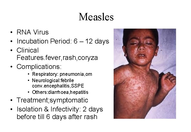 Measles • RNA Virus • Incubation Period: 6 – 12 days • Clinical Features.