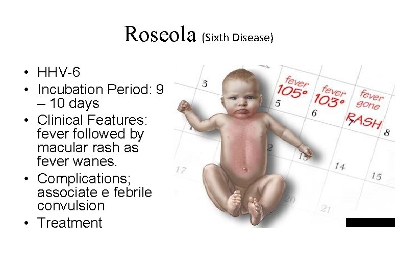 Roseola (Sixth Disease) • HHV-6 • Incubation Period: 9 – 10 days • Clinical