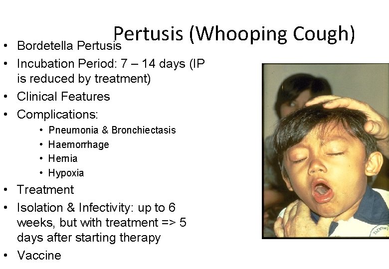 Pertusis (Whooping Cough) Bordetella Pertusis • • Incubation Period: 7 – 14 days (IP