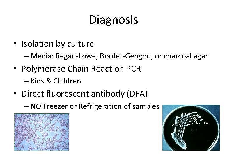 Diagnosis • Isolation by culture – Media: Regan-Lowe, Bordet-Gengou, or charcoal agar • Polymerase