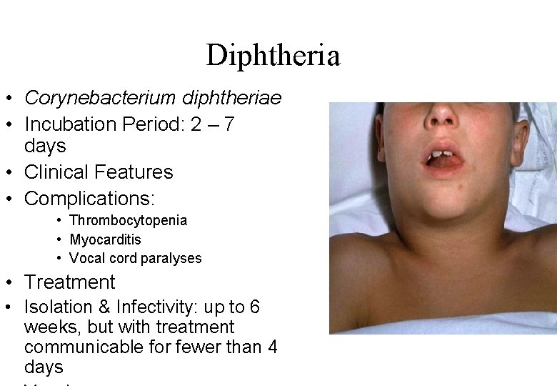 Diphtheria • Corynebacterium diphtheriae • Incubation Period: 2 – 7 days • Clinical Features