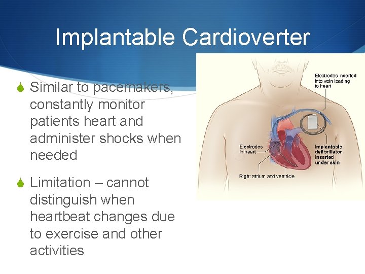 Implantable Cardioverter S Similar to pacemakers, constantly monitor patients heart and administer shocks when