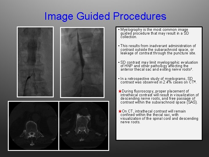Image Guided Procedures • Myelography is the most common image guided procedure that may