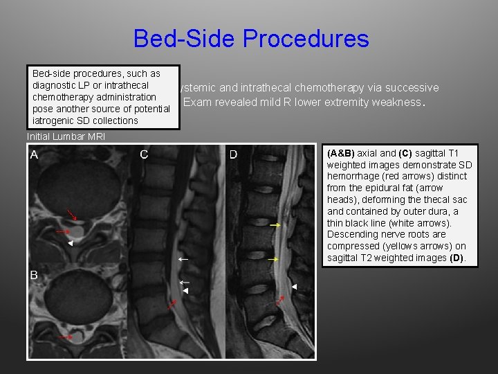 Bed-Side Procedures Bed-side procedures, such as or ALL intrathecal Adiagnostic 16 yo M LP